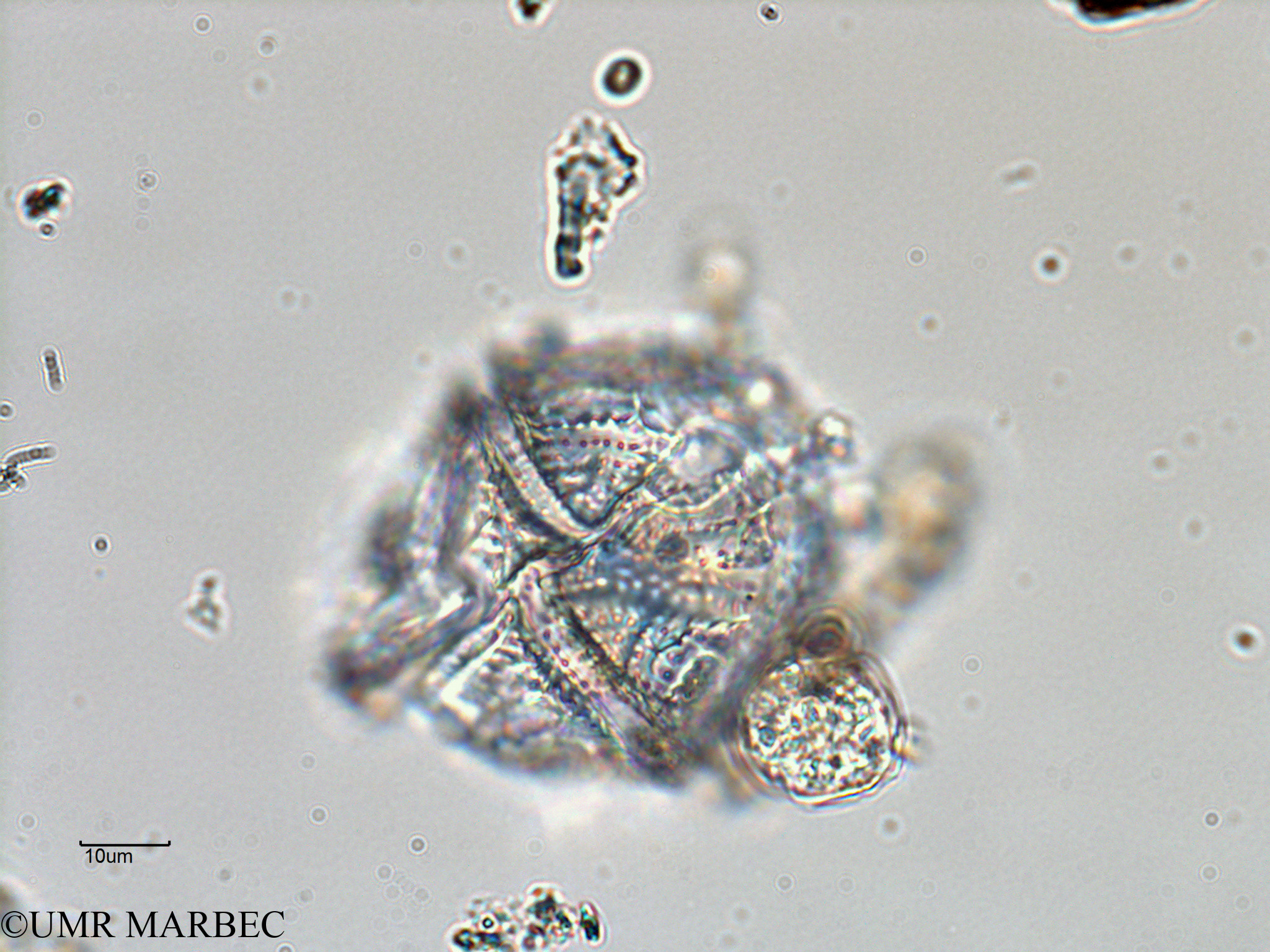 phyto/Bizerte/bizerte_bay/RISCO February 2015/Lingulodinium polyedrum (ancien Gonyaulax spinifera -ancien Baie_T5-ACW2-Gonyaulax-3).tif(copy).jpg